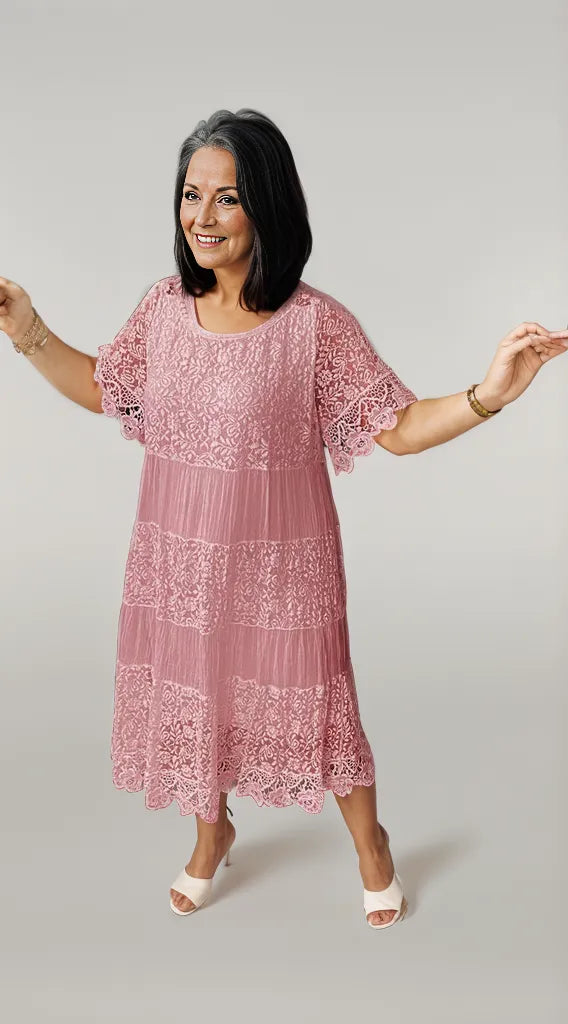 Alice™ | Casual Lace Dress