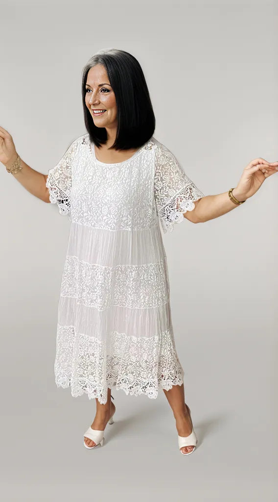 Alice™ | Casual Lace Dress
